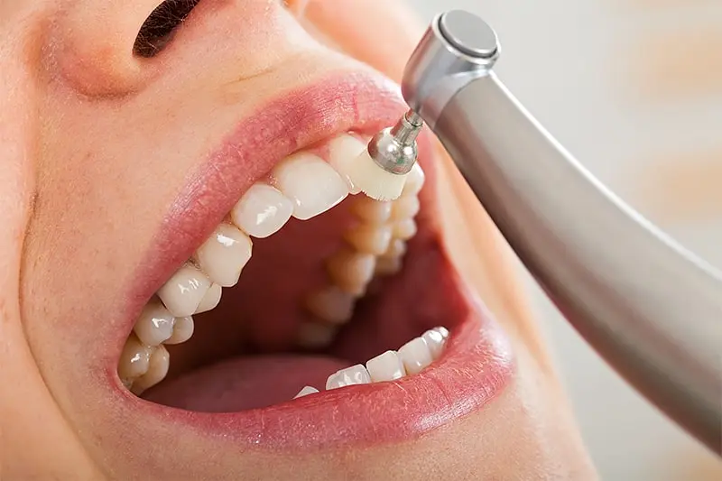 Hygienist